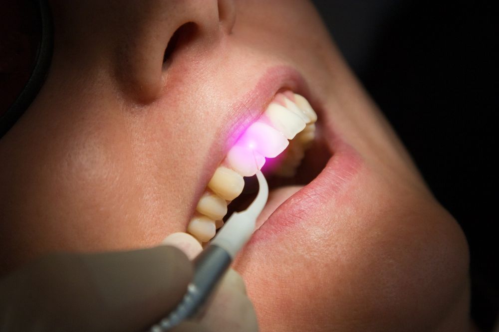 Про снятие чувствительности зубов диодным лазером